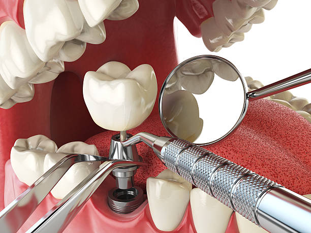 Dentist for Dental Trauma in IN